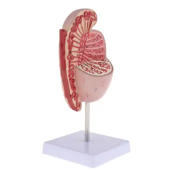 Viața Dimensiunea Umană Rinichi Bolnave Model Anatomice Anatomie Bolnave Patologice Piatra Organ Material Didactic